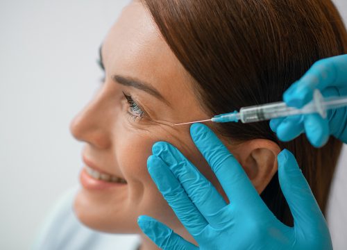 Woman getting botox in Fullerton CA