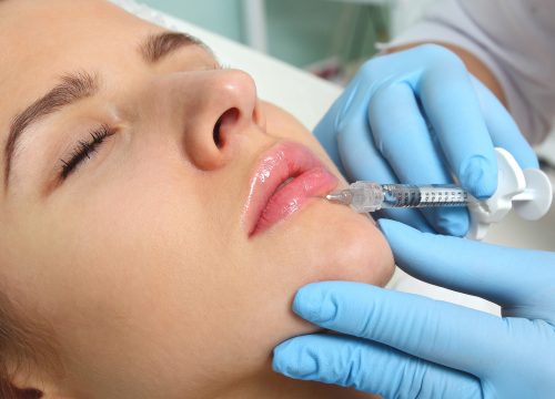 Woman getting Juvederm in her lips at expert aesthetic doctor in Fullerton CA