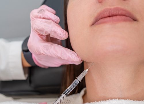 Woman getting Kybella Double Chin Treatment in Fullerton CA by Dr Kedy Jao