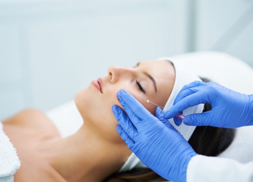 Woman getting procedure known as Thread Lift in Fullerton CA by Dr Kedy Jao